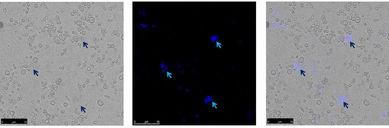 Figure 2: Bright field, DAPI-stained and DAPI-BF merged images of the nuclei isolated with the protocol of Dr. Ivan Llorens. The blue arrows point to DAPI-stained nuclei which were clumped together.