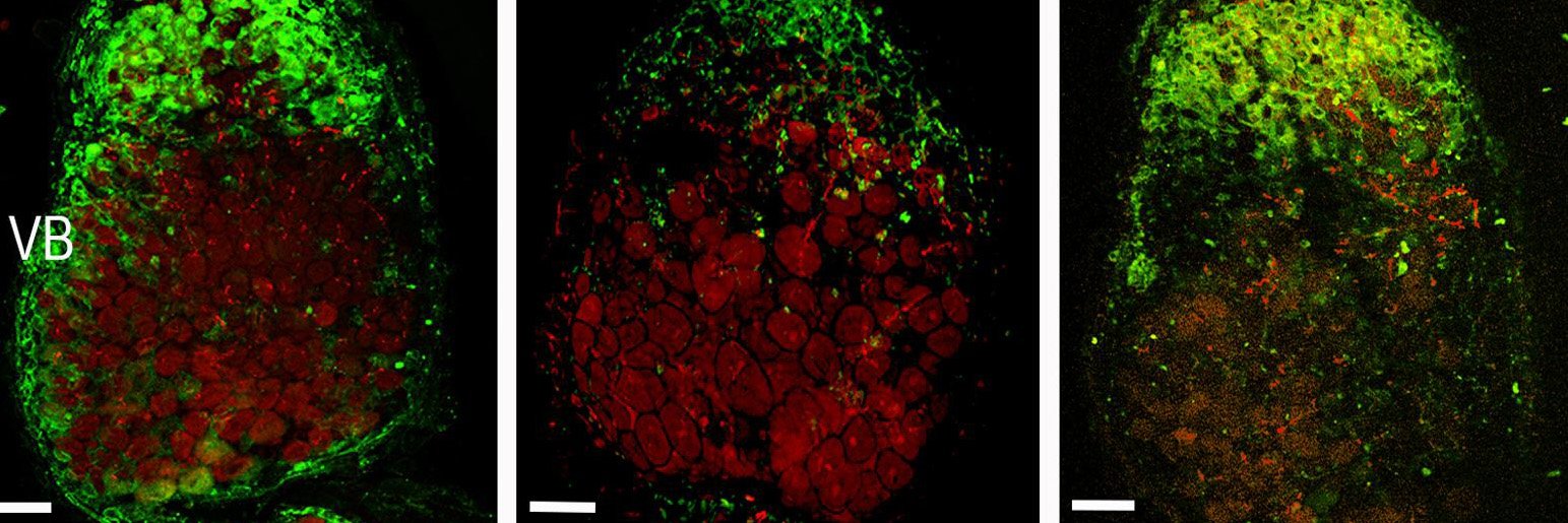 Actin visualization: to disclose mechanisms of host cell reorganisation during interactions with microbes