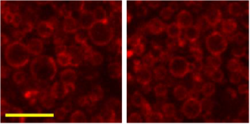 Figure 4. E. coli giant spheroplasts functionalised with fluorescent DNA nanostructures. Scale bar: 10 um.